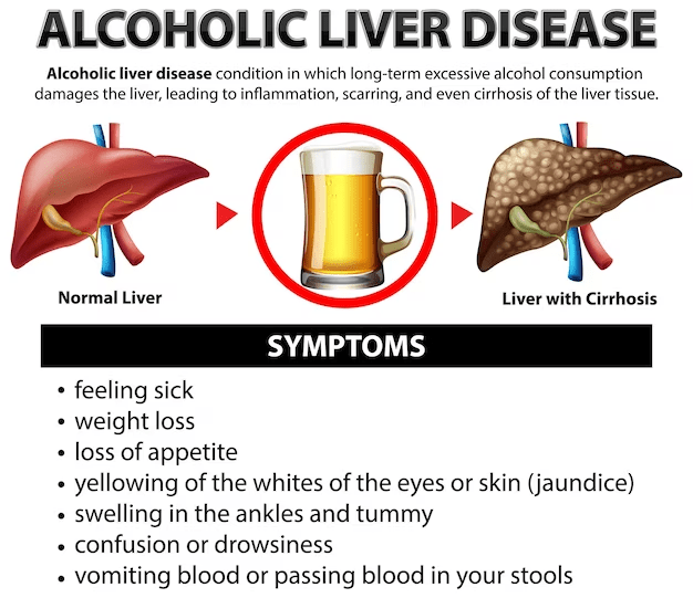 liver damage due to alcohol